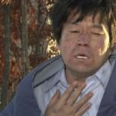 더마일스톤 이미지