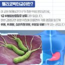 헬리코박터균 제균 약 술 병원 이미지