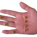 광명의료기 이미지