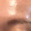 세라헤어라인 이미지