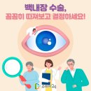 백내장 수술 피해 증가, 효과·부작용 정확히 알고 해야 이미지