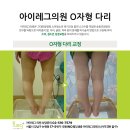 아이레그플러스의원 네이버블로그