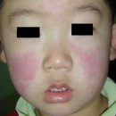 애플소아과의원 이미지