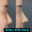 제이티성형외과의원 이미지