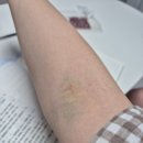 청구부부한의원 | [첫임신 기록] 4. 소파술 5일차 후기 및 수술 후 할 일 (유산보약, 몸조리, 보험청구, 여행계획 등)