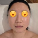 청주 신부관리 ｜복대동 윤곽관리 '리미 에스테틱' 얼굴라인 즉각 변화 후기