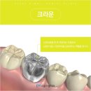 닥터오치과의원 | 치과 치료, 치료 종류, 치아 치료