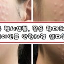 에젤피부과의원 | 연예인들 피부 회춘시킨다는 비장의 무기 리쥬란 힐러 스킨부스터 후기들