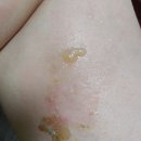 화상2 Daum카페