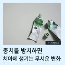 충치를 방치하면 치아에 생기는 무서운 변화