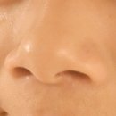 복코찜이 | 넓은 콧볼 고민, 노픈코 코교정기로 관리 후기