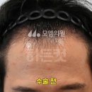 필헤어라인 - 북구 구암동 | 필헤어라인