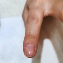 아띠랑스네일 | 화곡동 네일 손톱 건강 되찾은 아띠랑스네일 레푸스 화곡역점