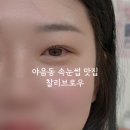 찰리뷰티펌