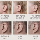 보청기클리닉 이미지