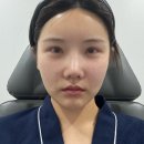 해리에스테틱 | 평택피부관리 웨딩관리 모공스파클렌징 더마인에스테틱