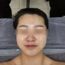 청주피부관리 맛집 &lt;홍 스킨&amp;바디&gt;에서 관리 받은 후기💖