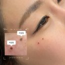 유로핏(FIT) | 건대 미인점 자연스럽게 잘하는 곳 찾는다면 (서울 미인점 후기)