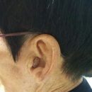 세라톤보청기 이미지