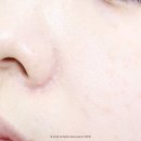 홈케어 피부관리기 플라닉프로 플라즈마 모공줄이는법 내돈내산 후기