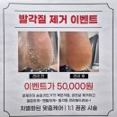 면목동-102 | 네일을정하다 :: 면목동 발각질관리 솔직 후기