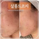 한들물빛약국 | 아산 살롱드코지: 탕정피부관리 전문 문제성피부 여드름케어 필링 받은 후기
