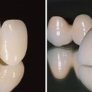 판치과기공소 이미지