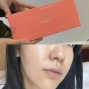 멍스토어 | 스킨부스터 종류 리투오 주기 맞춰 받은 후기 (효과, 통증, 멍, 가격)