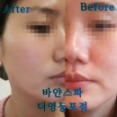 향기나는숲에스테틱향림 | 영등포피부관리 바얀스파 더영등포점 수분밀도 탄력 광채 케어 받은 후기