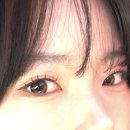 멍뽀인트 | 발품 없이 냅다 대구 쌍수 상담 예약 후 수술까지 해버린 후기 (+붓기 관리 꿀팁)