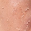 유리알스킨 | Retinol Gel 0.1%로 만든 유리알 피부 피부 루틴 후기｜40대 피부 관리 경험담