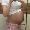 봉봉약국 | 세쌍둥이임신(21~24주)