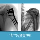 익산중앙영상의학과의원 네이버블로그