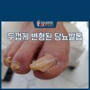 레푸스앤네일 이미지