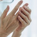 미사원탑신경외과의원 | “류마티스 초기 증상부터 관리법, 화타식 숭늉 효과, 약 부작용 경험담”