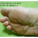 기적의 발각질제거 &lt;뷰티풋&gt; 상세한 사용후기~!