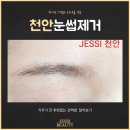1019 | 천안눈썹제거 지우기 전 후회없는 선택법!