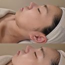3735 | 청주윤곽관리 ‘스파나인 강서점’ 울트라v9 예신관리로 받고온 후기