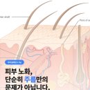 로얄자연에스파 | 울써마지 400샷, 600샷 효과부터 후기까지 모아보기