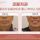 공백치과기공소 이미지