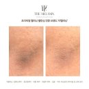 링링브로우 이미지