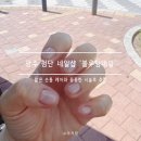 옷샵 첨단 | 물어뜯는 손톱 관리 | 짧은 손톱러도 걱정 없이 다녀온 첨단 네일샵 '블루밍네일'