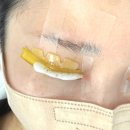 대백마트옥산점 | [경산 속눈썹펌 후기] 옥곡동 마이미니뷰티 : 뷰러없이 선명한 눈매 만들기♥