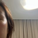 닥터제이에스케이(Dr.JSK)라제니쏭 멜라 안티 세럼 후기