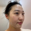 성북구 피부관리, 길음동 피부관리, 길음뉴타운 피부관리, 올가드림뷰티 길음점 체험 후기