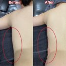 신갈마로-1 | 대전에스테틱 체형관리 잘하는 확실한 관리 레드핏 후기사진