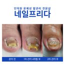 네일프리다 이미지