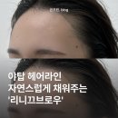 분당-354 | [뷰티] 야탑 여자 헤어라인 리니끄브로우, 성남 분당 눈썹/헤어라인 솔직후기