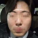 고고한의원 | 부평 여드름 한의원 여드름 흔적 관리 내돈내산 찐후기