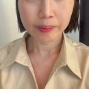 엑소좀 창원구강악안면외과 리쥬란 후기